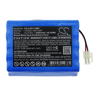 Battery for Cardioline 3 Digital ECG Delta 1 Plus Delta 3 Plus ECG Delta 1 ECG Delta 1+ ECG Delta 3+ 0593 120222 1220211-01 AMED5062 AS30008 B11429 BATT/110222 EE050319 OM11429