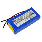 Battery for GE Responder 1000 Responder 1100 SCP 840 SCP 912 SCP840 SCP912 15N-800AA 20510002 88888235 92916531